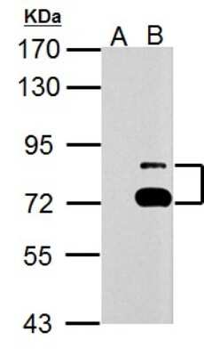 Western Blot: TTC39B Antibody [NBP2-15148]