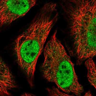 Immunocytochemistry/ Immunofluorescence: TTC39C Antibody [NBP2-56001]