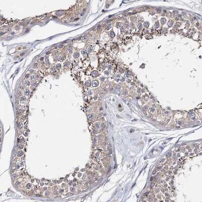 Immunohistochemistry-Paraffin: TTC40 Antibody [NBP1-90773]