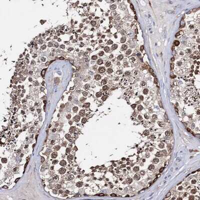 Immunohistochemistry-Paraffin: TTC40 Antibody [NBP2-48679]