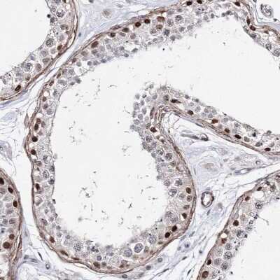 Immunohistochemistry-Paraffin: TTC40 Antibody [NBP2-48696]