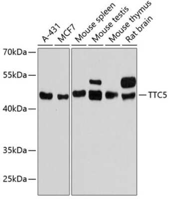 Western Blot: TTC5 AntibodyAzide and BSA Free [NBP2-93888]