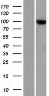 Western Blot: TTC7A Overexpression Lysate [NBP2-06642]