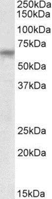 Western Blot: TTC8 Antibody [NBP1-49869]