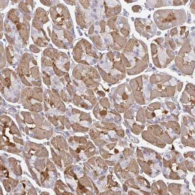 Immunohistochemistry: TTC9C Antibody [NBP2-31595]