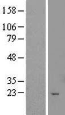 Western Blot: TTC9C Overexpression Lysate [NBL1-17414]