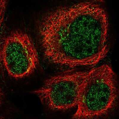 Immunocytochemistry/ Immunofluorescence: TTDN1 Antibody [NBP2-31718]
