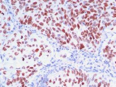 Immunohistochemistry-Paraffin: TTF-1 / NKX2-1 Antibody (8G7G3/1 + NX2.1/690) - IHC-Prediluted [NBP2-48118]