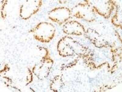 Immunohistochemistry-Paraffin: TTF-1 / NKX2-1 Antibody (8G7G3/1) - IHC-Prediluted [NBP2-48103]