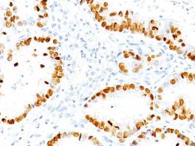 Immunohistochemistry-Paraffin: TTF-1 / NKX2-1 Antibody (NX2.1/690) [NBP2-44500]