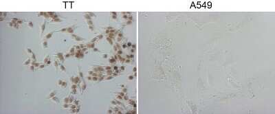 Immunohistochemistry-Paraffin: TTF-1 / NKX2-1 Antibody (OTI10F8) [NBP2-46175]