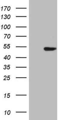 Western Blot: TTF-1 / NKX2-1 Antibody (OTI10F8) [NBP2-46175]