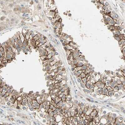 Immunohistochemistry-Paraffin: TTF2 Antibody [NBP1-83148]