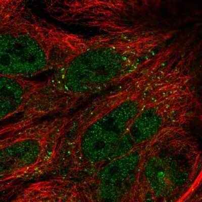 Immunocytochemistry/ Immunofluorescence: TTI1 Antibody [NBP2-57828]