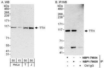 Western Blot: TTI1 Antibody [NBP1-79034]