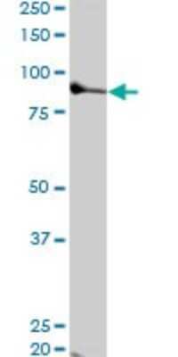 Western Blot: TTK Antibody (3G7) [H00007272-M01]