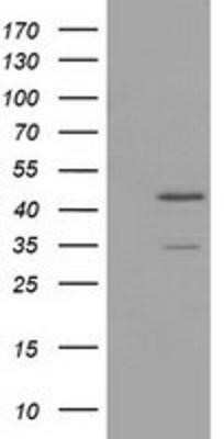 Western Blot: TTL Antibody (OTI3G5)Azide and BSA Free [NBP2-74668]