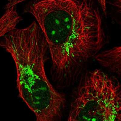 Immunocytochemistry/ Immunofluorescence: TTLL1 Antibody [NBP2-13491]