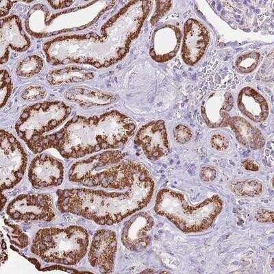 Immunohistochemistry-Paraffin: TTLL1 Antibody [NBP2-13491]