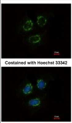 Immunocytochemistry/ Immunofluorescence: TTLL10 Antibody [NBP2-20755]