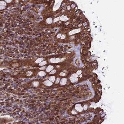 Immunohistochemistry-Paraffin: TTLL10 Antibody [NBP1-93819]