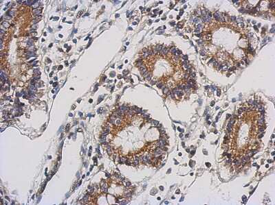 Immunohistochemistry-Paraffin: TTLL10 Antibody [NBP2-20755]