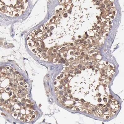 Immunohistochemistry-Paraffin: TTLL12 Antibody [NBP2-33852]