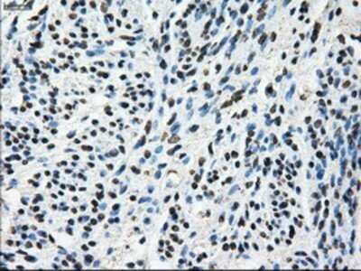Immunohistochemistry: TTLL12 Antibody (OTI7F11) - Azide and BSA Free [NBP2-74676]