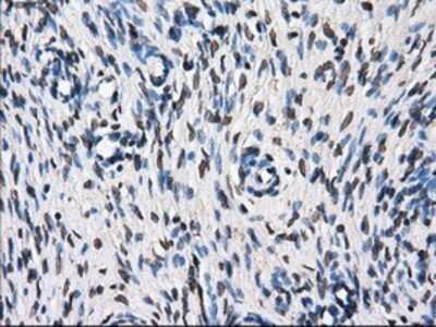 Immunohistochemistry: TTLL12 Antibody (OTI7F11) - Azide and BSA Free [NBP2-74676]