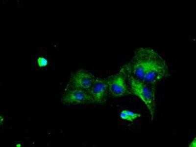 Immunocytochemistry/ Immunofluorescence: TTLL12 Antibody (OTI7F11) [NBP2-02216]