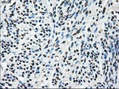 Immunohistochemistry-Paraffin: TTLL12 Antibody (OTI7F11) [NBP2-02216]