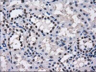Immunohistochemistry-Paraffin: TTLL12 Antibody (OTI7F11) [NBP2-02216]