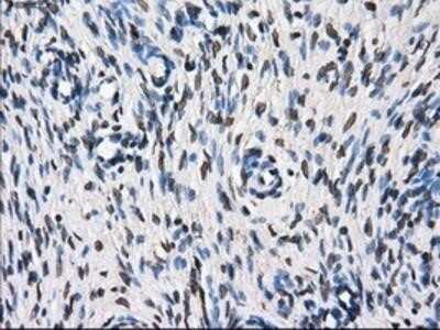 Immunohistochemistry-Paraffin: TTLL12 Antibody (OTI7F11) [NBP2-02216]