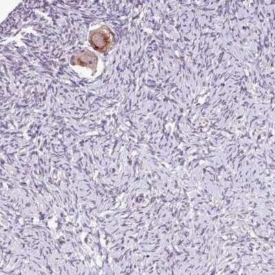 Immunohistochemistry-Paraffin: TTLL3 Antibody [NBP2-13493]