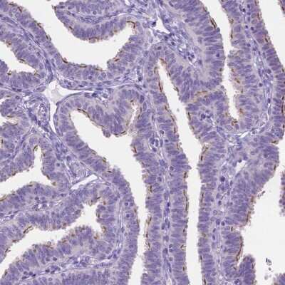 Immunohistochemistry-Paraffin: TTLL6 Antibody [NBP2-49041]