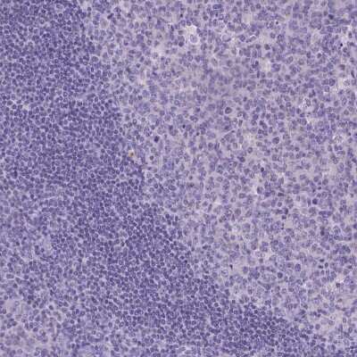 Immunohistochemistry-Paraffin: TTLL6 Antibody [NBP2-49041]