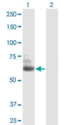 Western Blot: TTLL6 Antibody [H00284076-B01P]