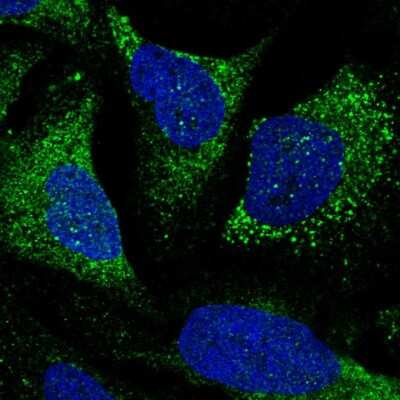 Immunocytochemistry/ Immunofluorescence: TTLL7 Antibody [NBP2-57232]