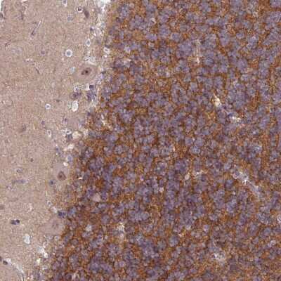 Immunohistochemistry-Paraffin: TTLL7 Antibody [NBP2-49038]