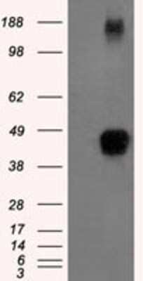 Western Blot: TTP Antibody (OTI8B5) [NBP2-02105]