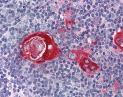 Immunohistochemistry: TTP Antibody [NBP2-86882]