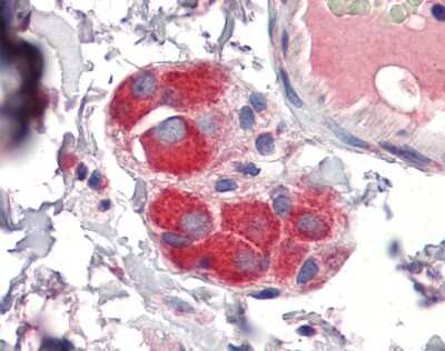 Immunohistochemistry-Paraffin: TTP Antibody [NBP2-86884]