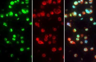 Immunohistochemistry-Paraffin: TTP Antibody [NBP3-12978]