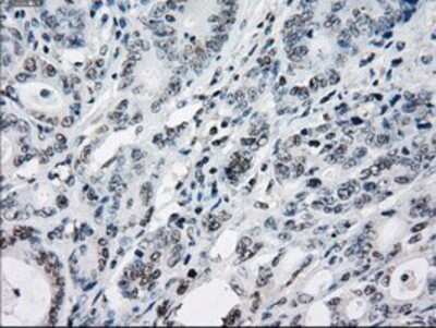 Immunohistochemistry: TTP Antibody (OTI8B5) - Azide and BSA Free [NBP2-74681]
