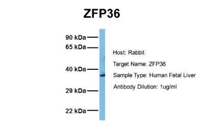 Western Blot: TTP Antibody [NBP2-86881]