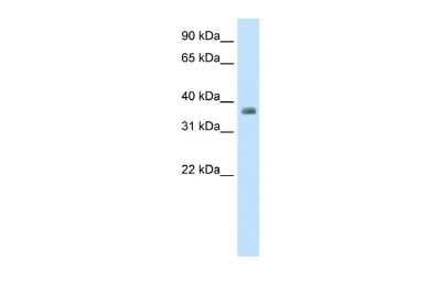 Western Blot: TTP Antibody [NBP2-86883]