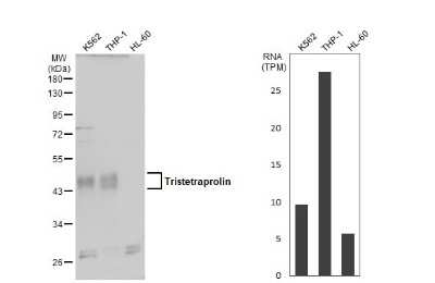 Western Blot: TTP Antibody [NBP3-12978]