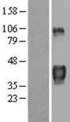 Western Blot: TTP Overexpression Lysate [NBL1-18018]