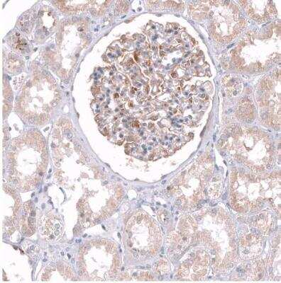 Immunohistochemistry-Paraffin: TTYH3 Antibody [NBP2-30621]