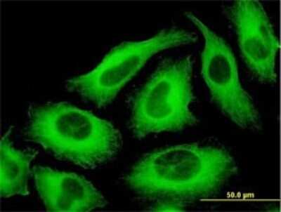 Immunocytochemistry/ Immunofluorescence: TUBA6 Antibody (1D2-H5) [H00084790-M01]